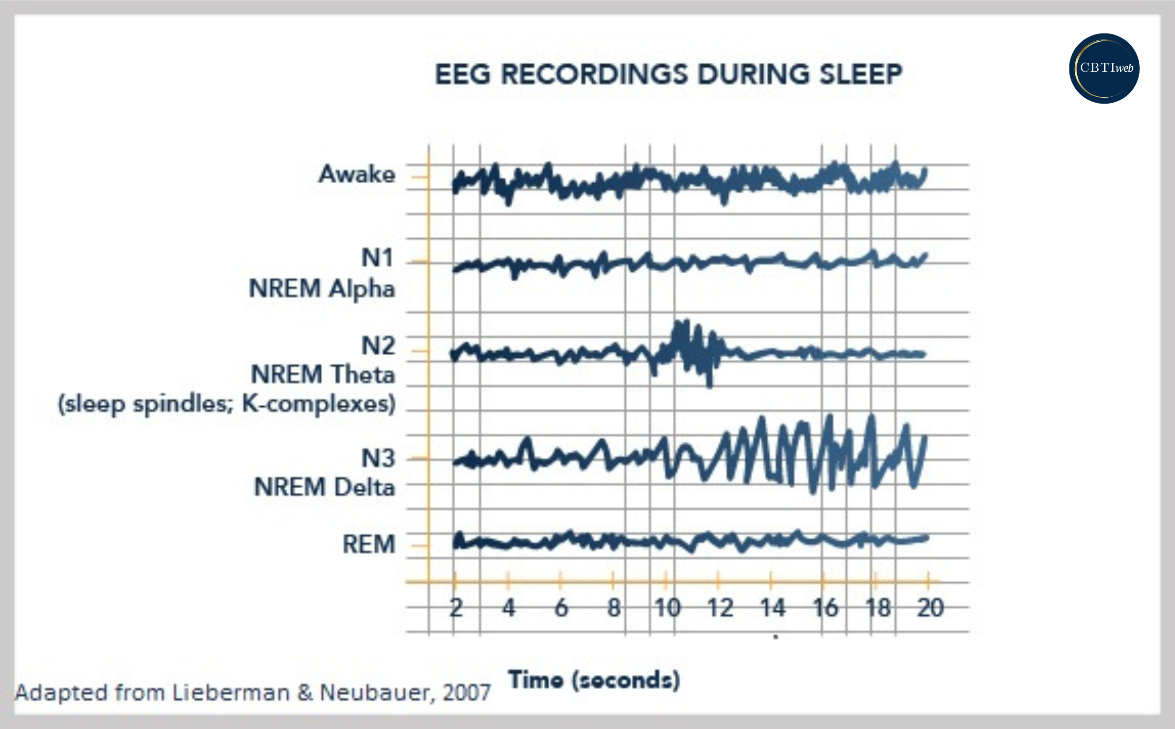 Basics of Sleep - EEG